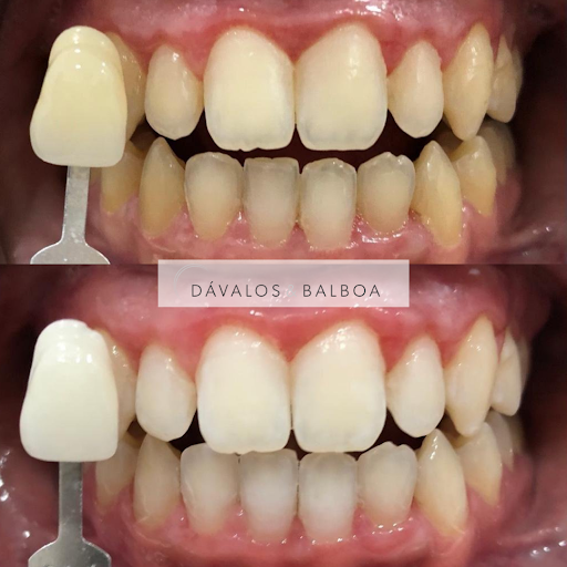 Clínica Dental Dávalos & Balboa