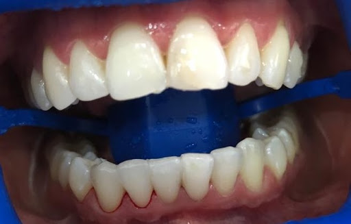 Clínica Dental Dentobell`e